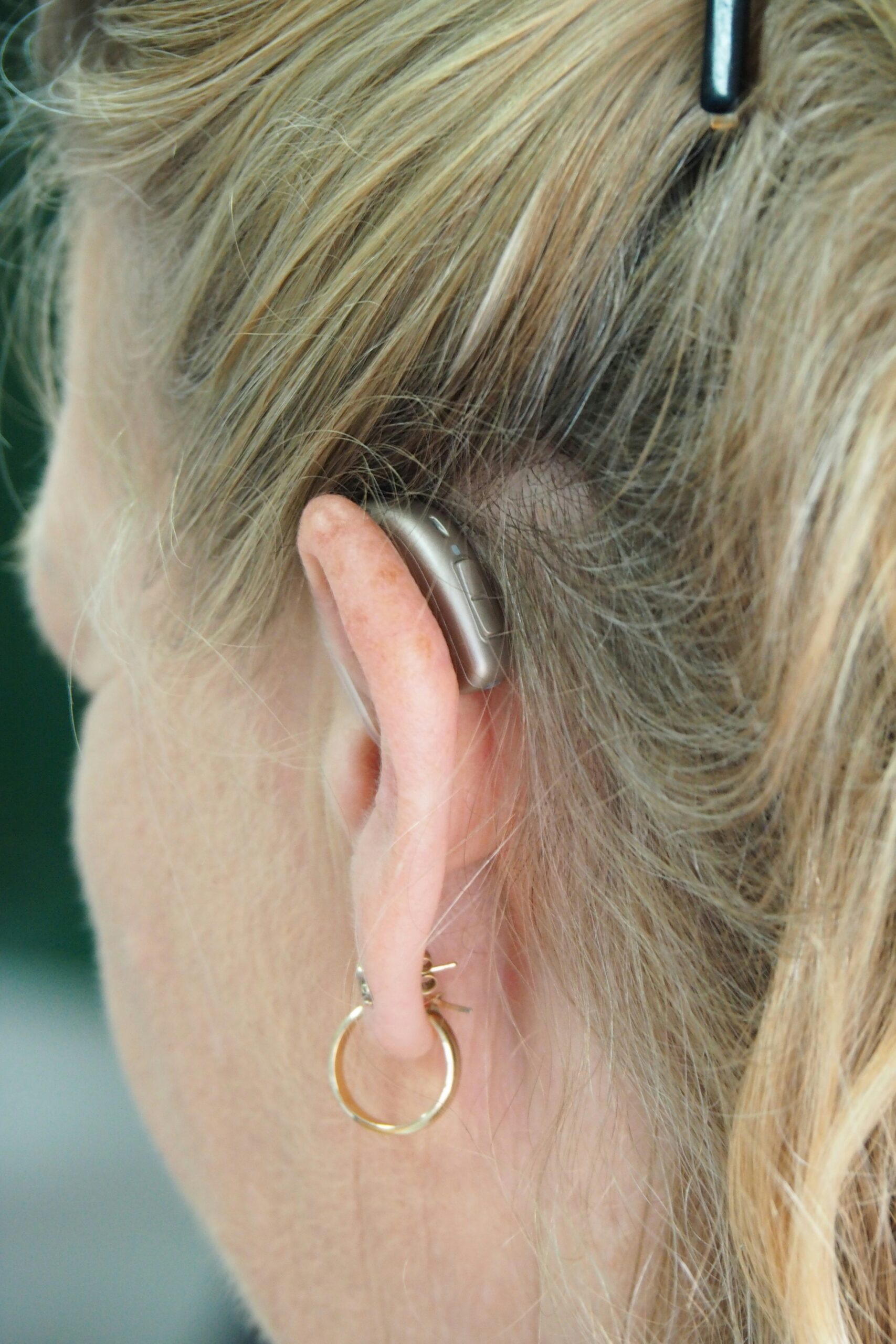 Hearing Aids Northern Beaches